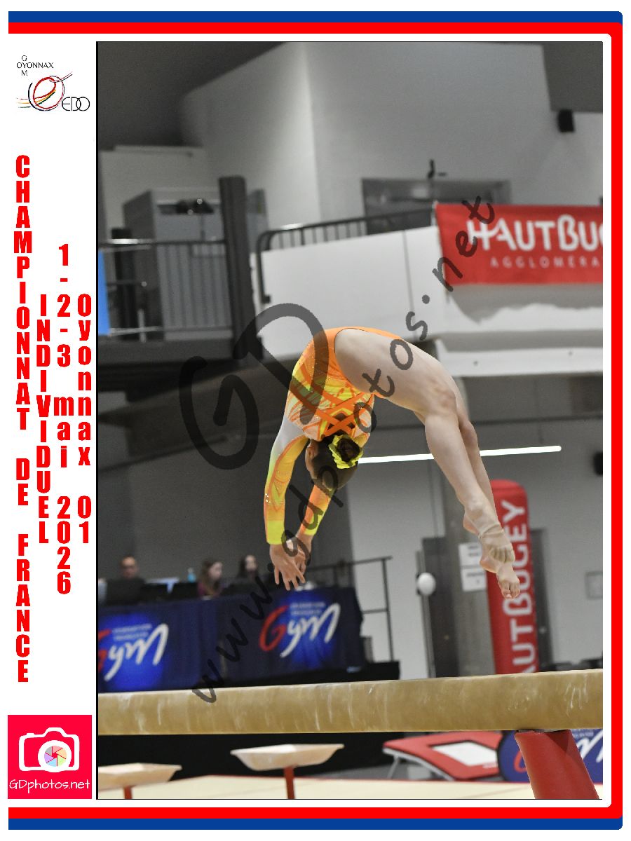 5311657