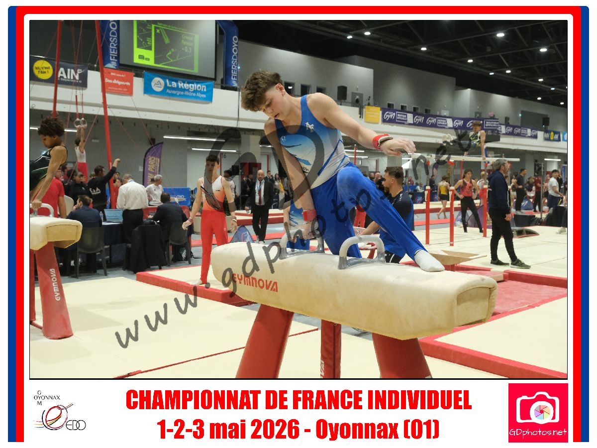 5355612